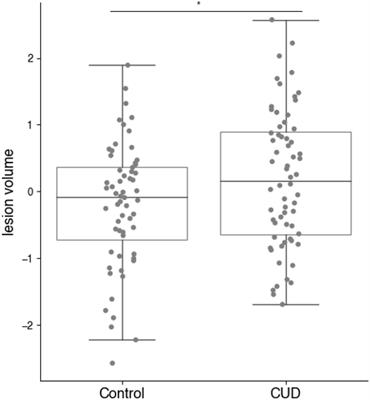 Detecting Small Vessel Pathology in Cocaine Use Disorder